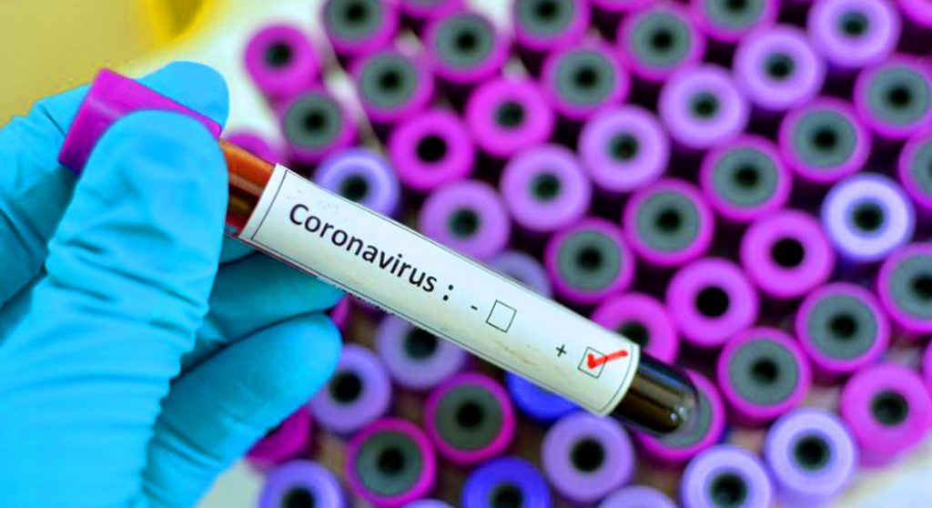 coronavirus